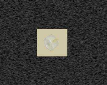 Zoom image